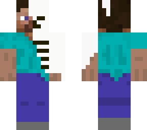 steve half skin burned off