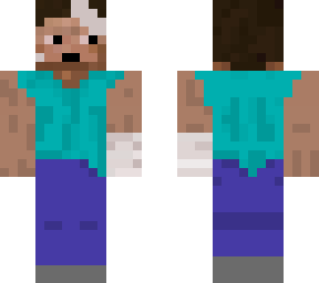 steve bandages