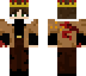 king with hurt hand 2.0