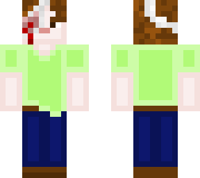 noodlehead casual injured