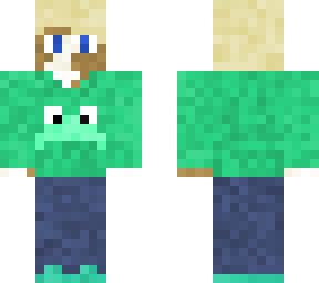 vitiligo boy in frog sweater