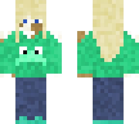 vitiligo girl in frog sweater