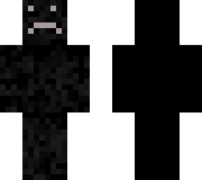 burned boy