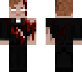 tarrare stage 2 death