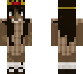 vitiligo dark academia queen