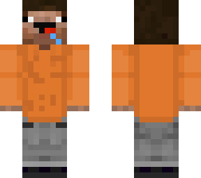 vinayakdhiman's prvate skin