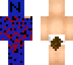 niglos skin