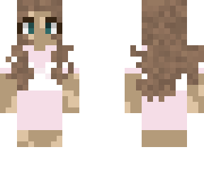 cute vitiliog girl
