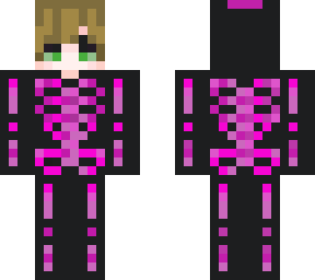 skeleton boy albert