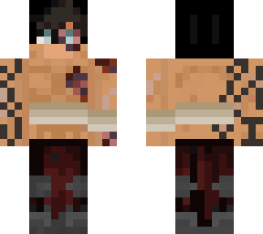 azrie with bandages