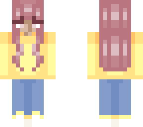 vitiligo