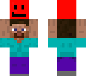 steve holding my head