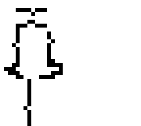 ocd