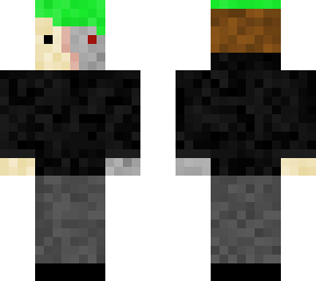 my skin... idk why i'm uploading this