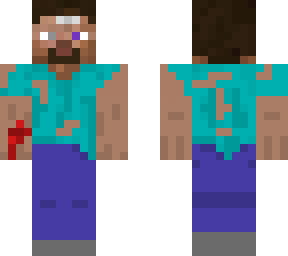 wounded steve