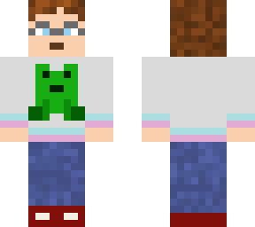mio skin 3