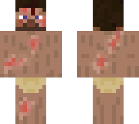caveman steve wounded