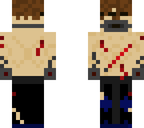 beaten prisoner i guess?