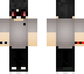 myopi01