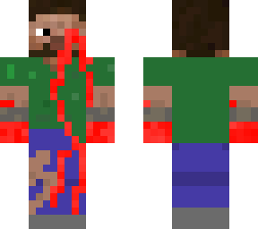 cuts and bruises