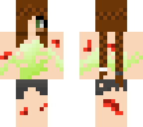 depressed adilinia (redo)