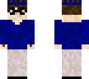 anthonys skin
