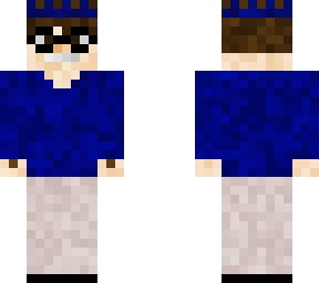 anthonys skin edit