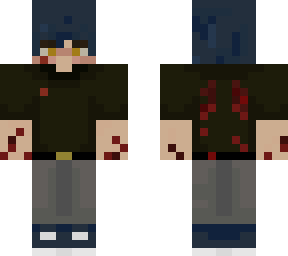 zeki fell ouchie