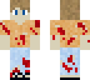 injured boy
