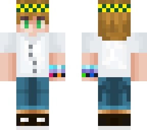 my skin update