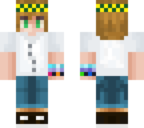 my skin update