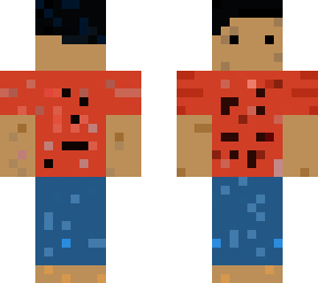 skin