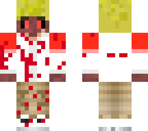 tommyoneofit skin