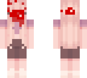 heavy nosebleed
