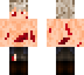 injured bakugo