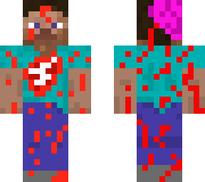 wounded steve