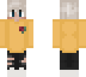 albino boy