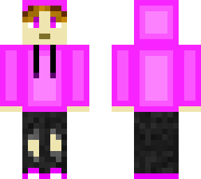 casual murkey skin