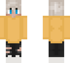 finished albino boy
