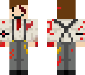 ryan's casino skin