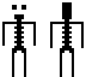 skeleto