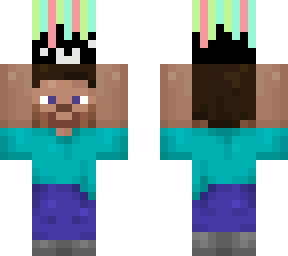 steve holding my head