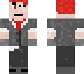 basically my skin