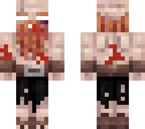 wounded forest bandit