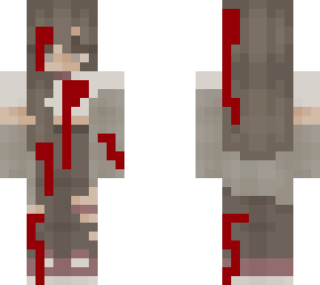 injured girl