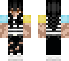 vitiligo girl