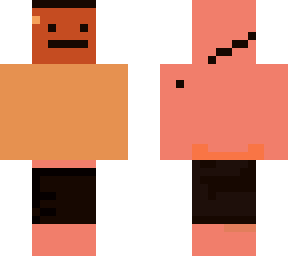 sunburned man