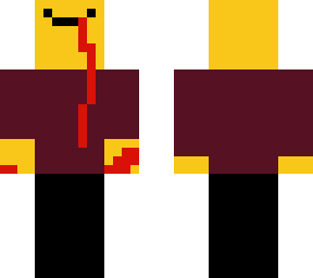 he was in a fight