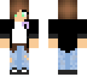 technosupport skin