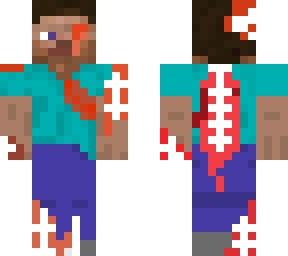 beaten up steve